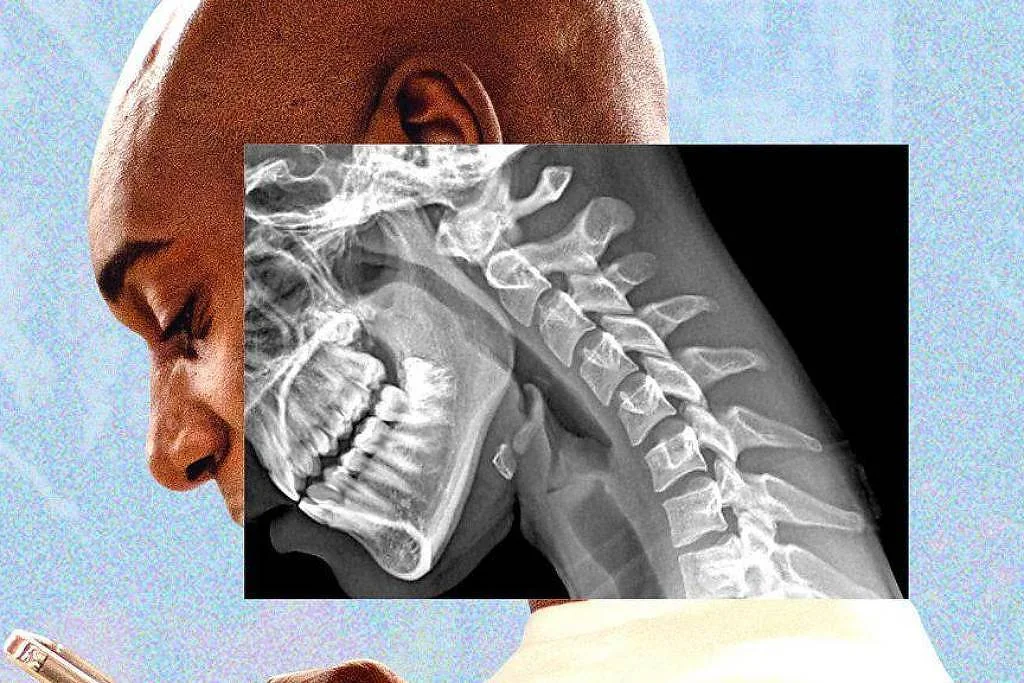 Mãos fracas e visão turva: celular está deformando nosso corpo